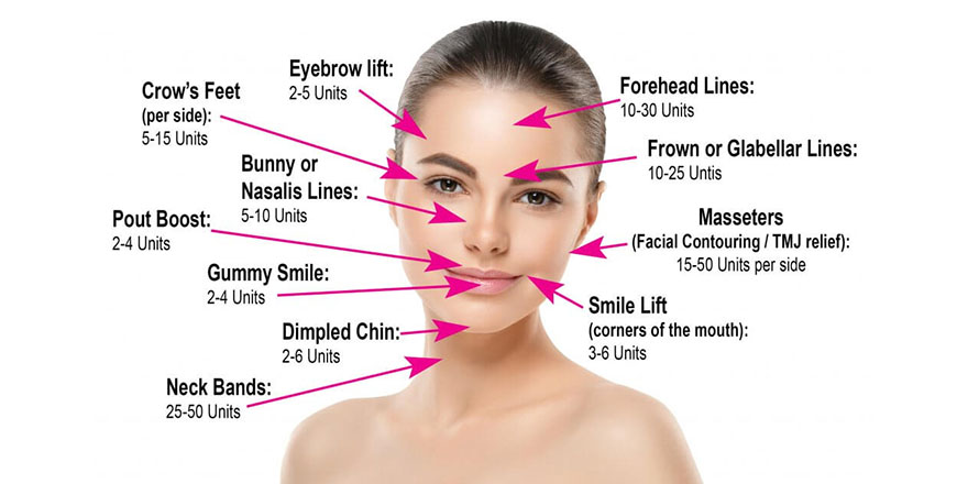 تزریق بوتاکس جهت زیبایی