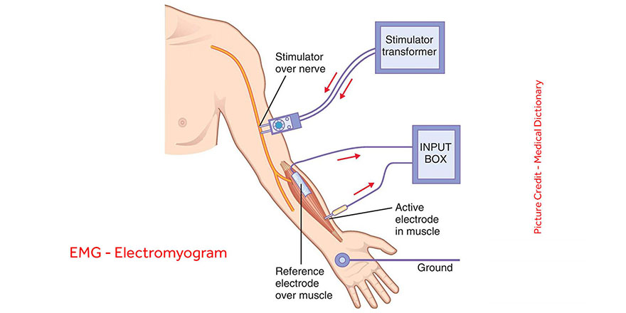 نوار عصب و عضله