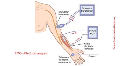 نوار عصب و عضله